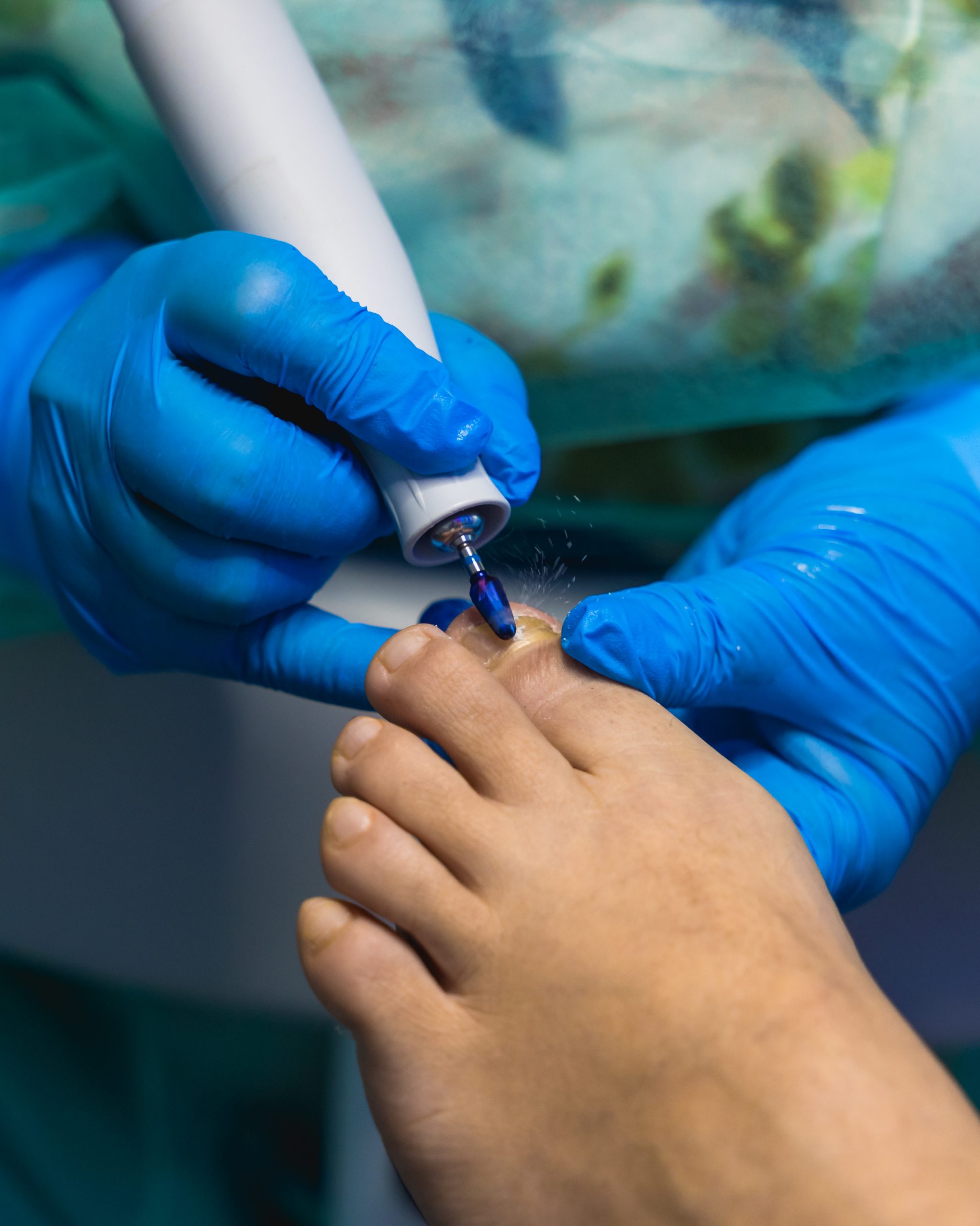Pedicure Técnica